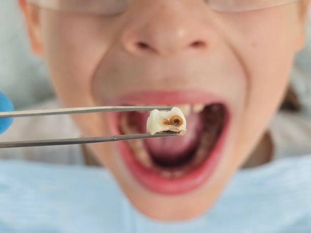 Best Pediatric Emergency Dentist in Watertown, NY